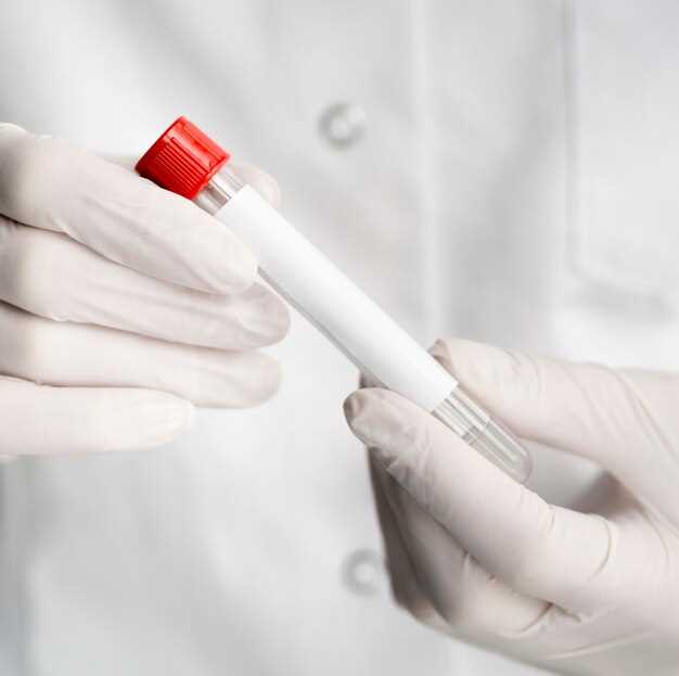 The Role of Laboratory Tests