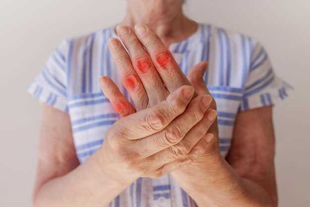 Understanding Rheumatoid Arthritis